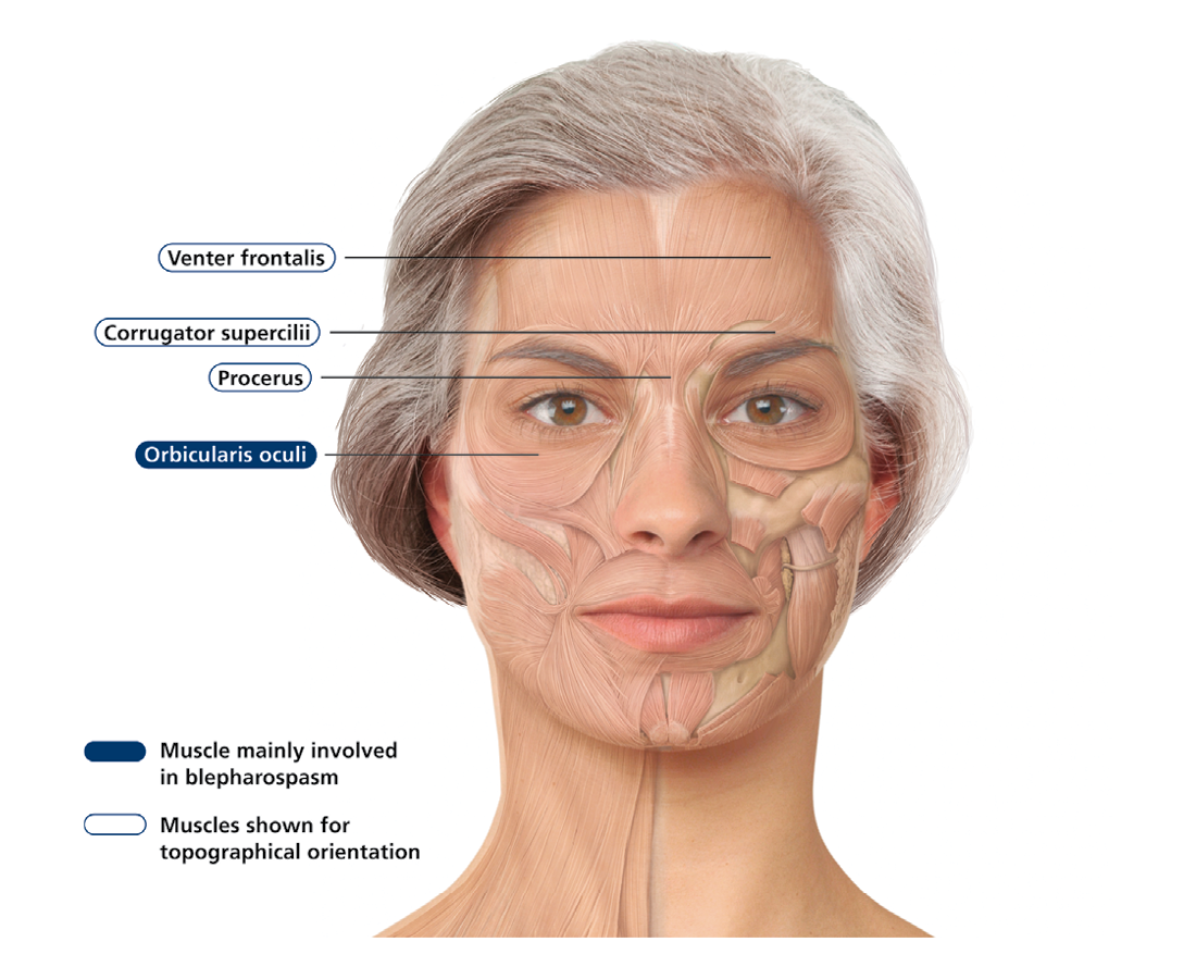 blefaroplastika